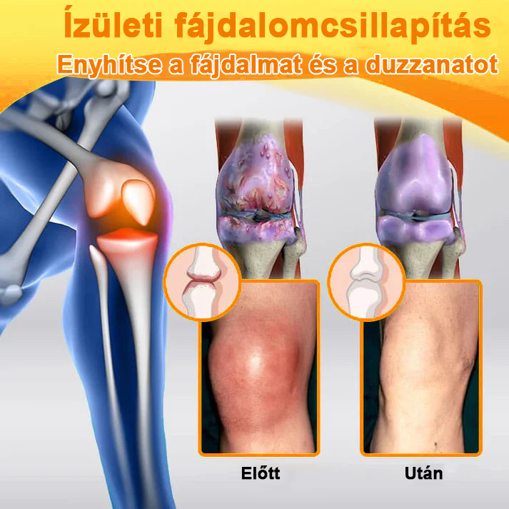 ✅✅Hivatalos Áruház: Ourlyard™ Magnézium Olaj és Méhméreg ízületjavító spray 👨‍⚕️ A Gyógyszerügyi Hivatal (OGYEI) jóváhagyásával