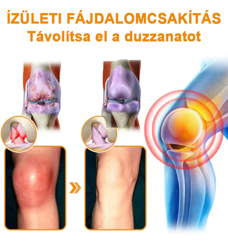 ✅✅Hivatalos Áruház: Ourlyard™ Magnézium Olaj és Méhméreg ízületjavító spray 👨‍⚕️ A Gyógyszerügyi Hivatal (OGYEI) jóváhagyásával