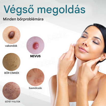 ✅✅✅Bikenda® non-invazív anyajegy- és szemölcseltávolító lézertoll