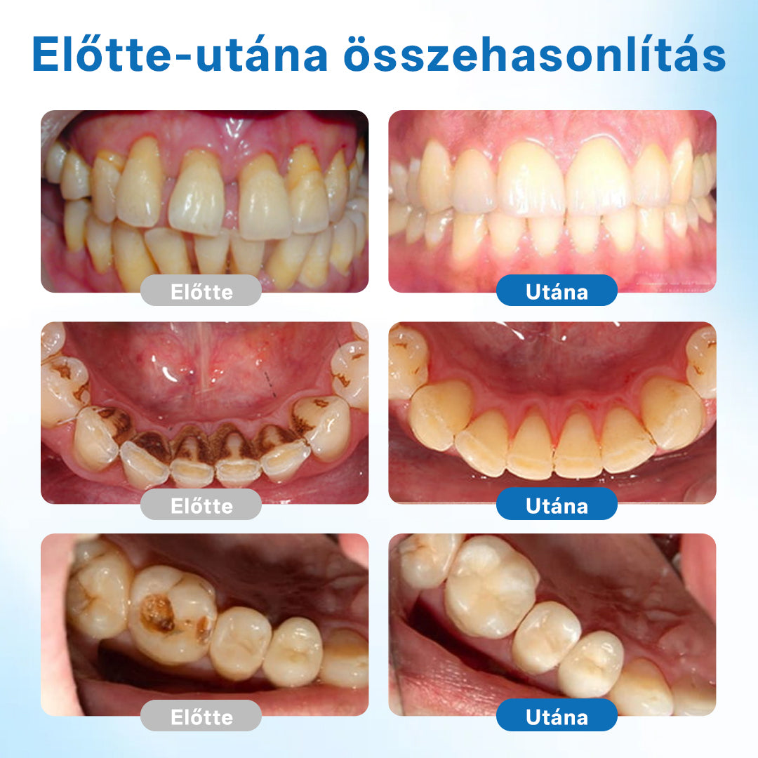 🔥Biancat® NanoHAP Tooth Defense Serum