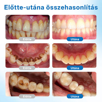 🔥Biancat® NanoHAP Tooth Defense Serum