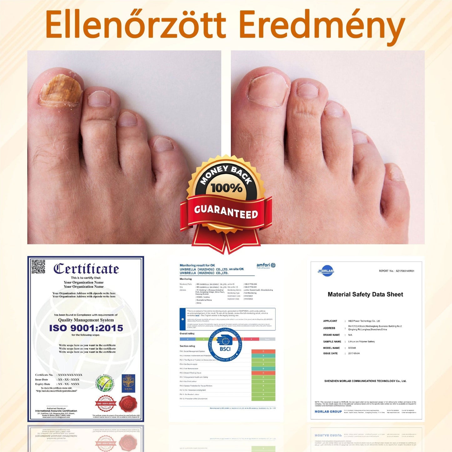 Croaie® Fungiclear Bee Therapy Nail Spray🎁🎁