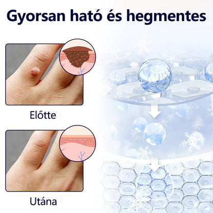 Timilk®🌲 WartErase – Fagyasztó Szemölcseltávolító Spray