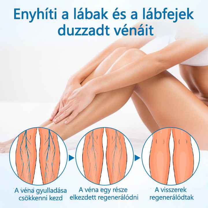 Timilk® VeinGuard Herbal Spray-✅ Klinikailag bizonyítottan 7 nap alatt megszünteti a visszerességet!