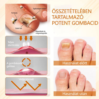 Croaie® Fungiclear Bee Therapy Nail Spray🎁🎁