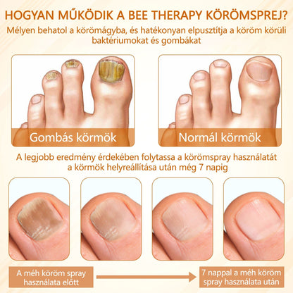 Croaie® Fungiclear Bee Therapy Nail Spray🎁🎁