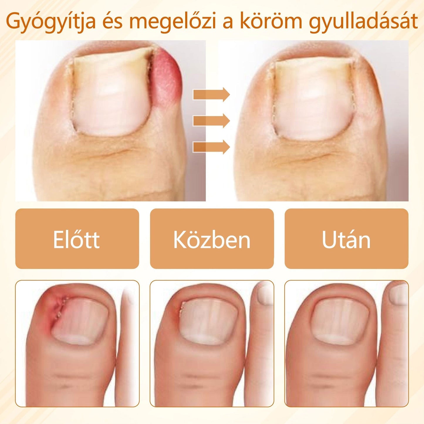 Croaie® Fungiclear Bee Therapy Nail Spray🎁🎁