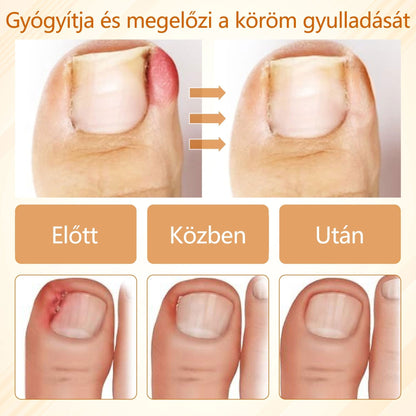 Croaie® Fungiclear Bee Therapy Nail Spray🎁🎁