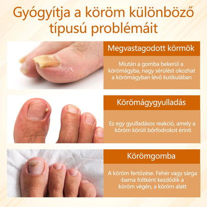 Croaie® Fungiclear Bee Therapy Nail Spray🎁🎁